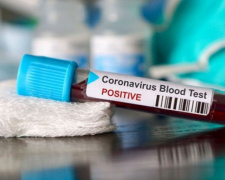 У Дніпропетровській області виявили 71 новий випадок коронавірусу