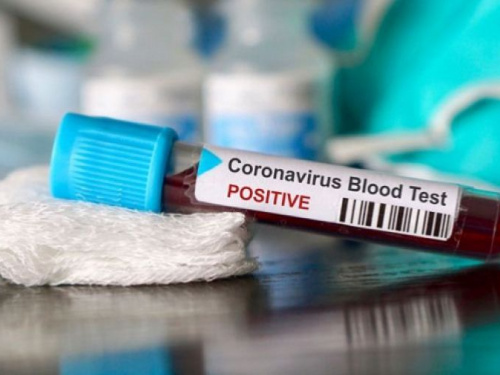 На Дніпропетровщині виявили 295 нових випадків коронавірусу
