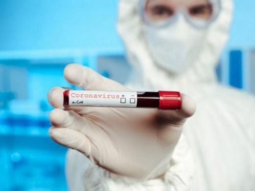 На Дніпропетровщині виявили 302 нові випадки коронавірусної хвороби