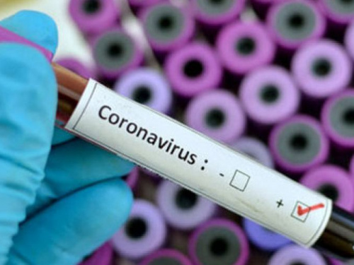 У Дніпропетровській області виявили 3 нові випадки коронавірусу