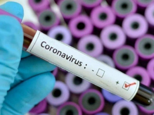У Дніпропетровській області виявили 12 нових випадків зараження COVID-19