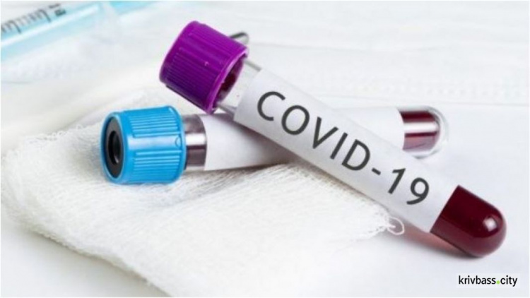 В Днепропетровской области подтвердили ещё 29 случаев инфицирования COVID-19