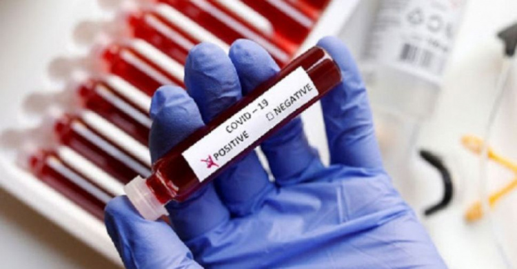 На Дніпропетровщині виявили 296 нових випадків коронавірусу