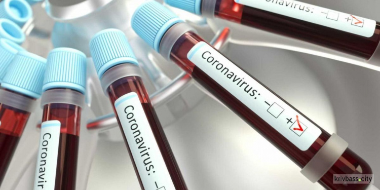 У 119 жителей Кривого Рога подозревают заражение коронавирусом