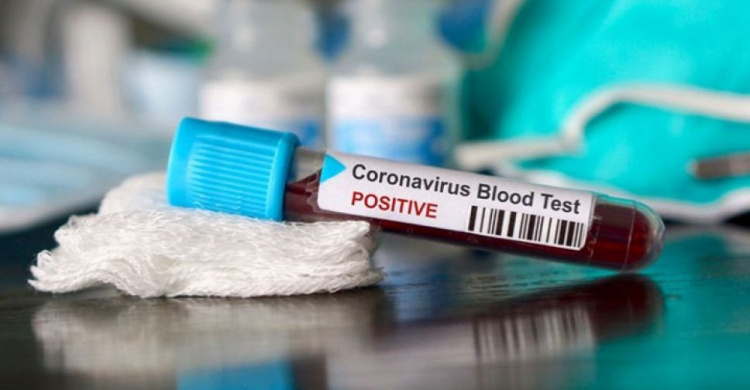 На Дніпропетровщині виявили 136 нових випадків коронавірусної хвороби