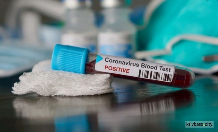 В Днепропетровской области за сутки подтвердили 7 случаев заражения коронавирусом