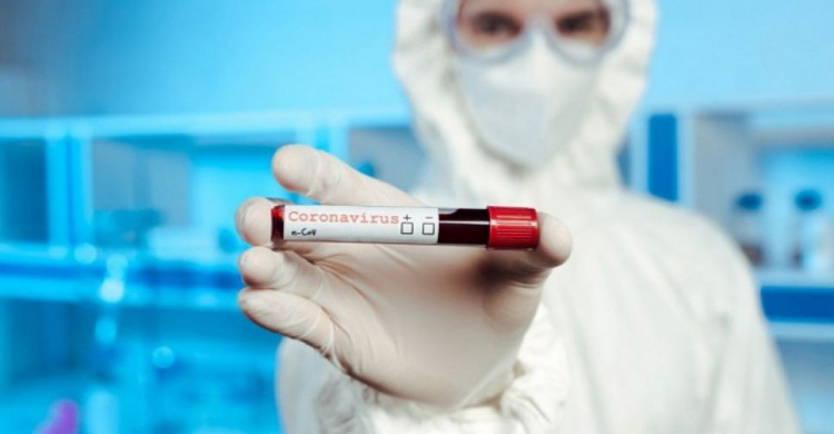 На Дніпропетровщині виявили 342 нові випадки коронавірусу